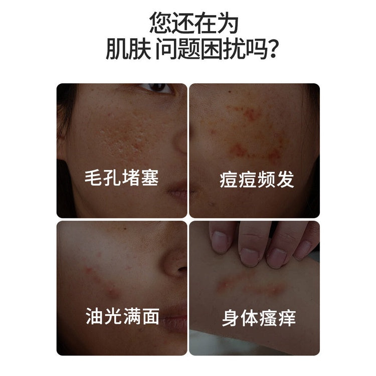 85g Authentic Shanghai Sulfur Soap Eczema Soap Anti-Acne Anti-Mite Soap上海硫磺皂 去除螨虫 抗痘肥皂- 85g
