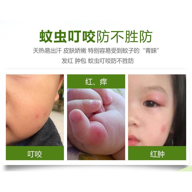 现货 - Mugwort Balm / Cream For Baby / Child - Anti Mosquito Bite 儿童清凉油膏 - 艾草香膏 / 艾草膏 - 灸疮婴儿蚊虫叮咬止痒祛红肿烫伤修复皮肤