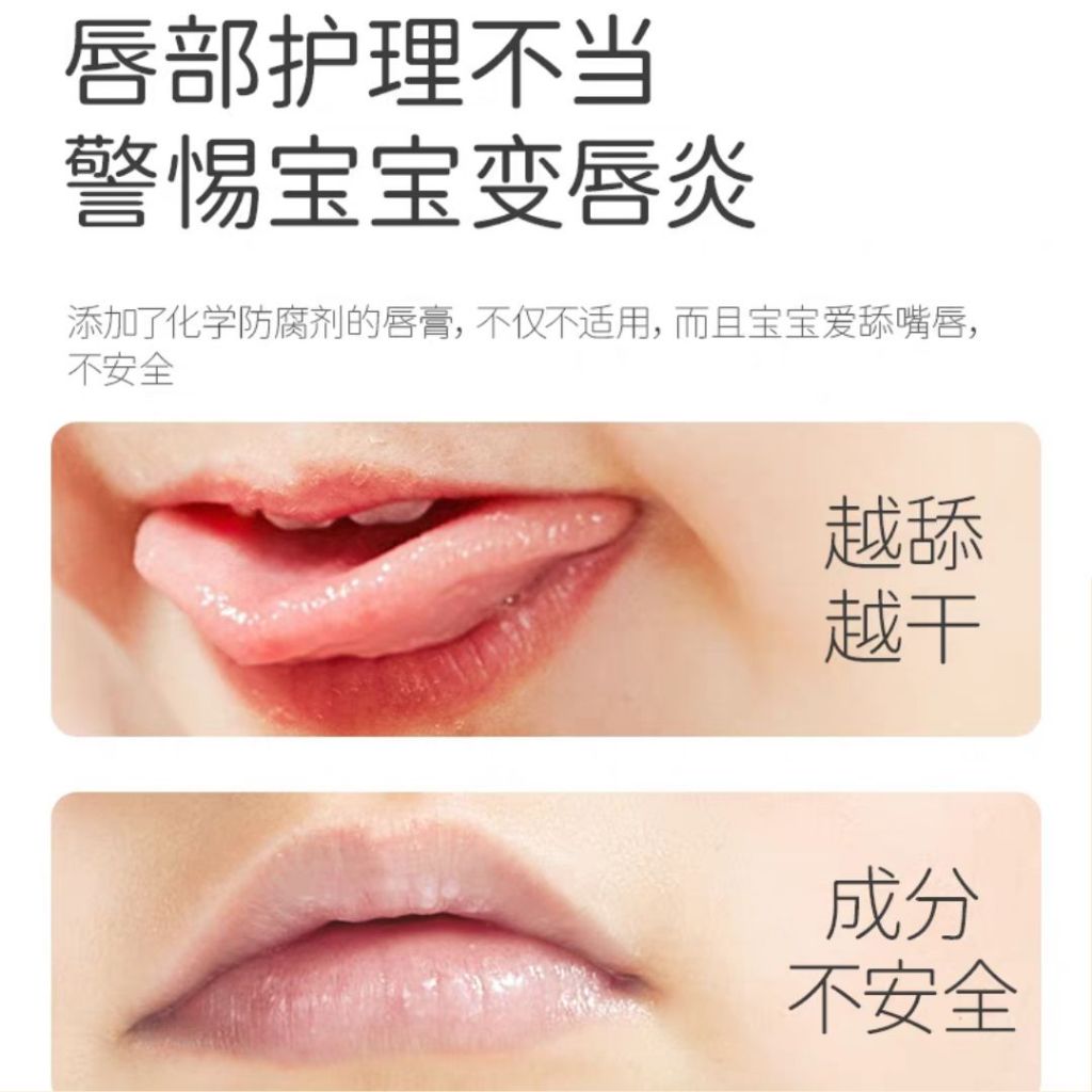 0岁宝宝孕妇护唇膏 0 Year Old Baby and Pregnant Women Natural Lip Balm 儿童润唇膏 宝宝润唇膏 Kid Lip Balm Children Lip Balm Baby Lip Balm