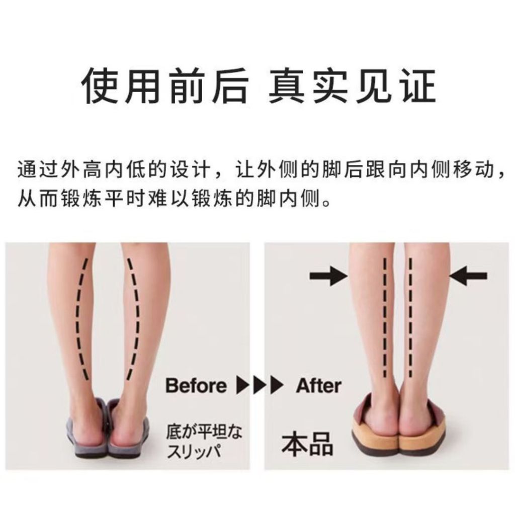 Size 36-39 O型腿矫正室内鞋 O-shaped Leg Indoor Correction Shoes