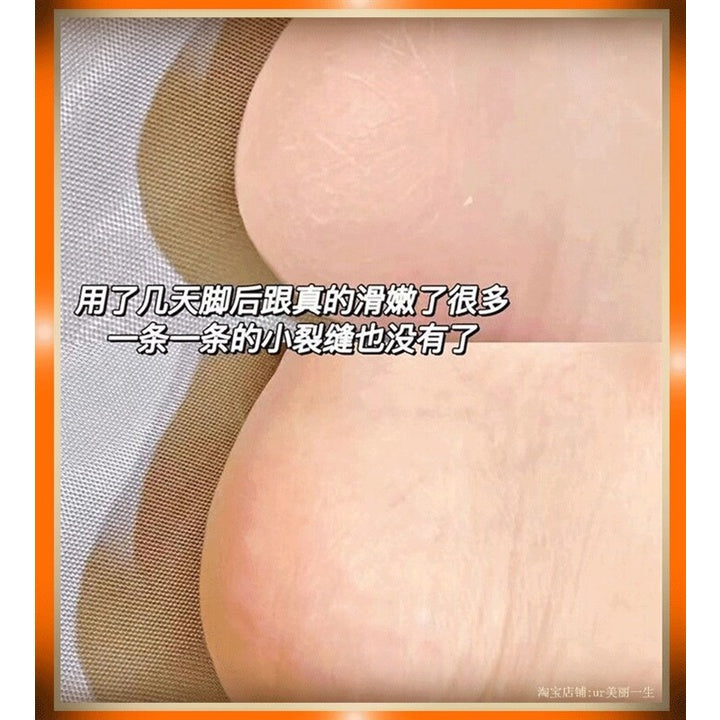 60ml 魅点凡士林脚后跟干裂滚珠足部皴裂膏 脚跟滋润保湿膏 Vaseline Nourishing Anti Cracking Cream Anti Cracked Heel 手足滋润皲裂膏防脚龟裂 脚跟滋润膏 保湿脚跟