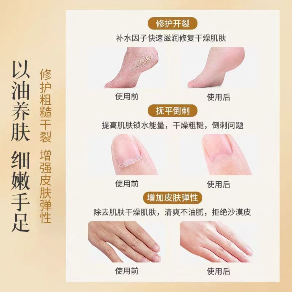 10ml 三花三籽精油护甲油 淡化手纹滋润甲边 3 Flower & 3 Seed-Based Nail Care Essential Oil Roller 三花三籽美甲指缘精华油营养油护理缝修  防干裂滋润补水滋养亮指甲美甲护理